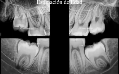 Odontología forense: una mirada global